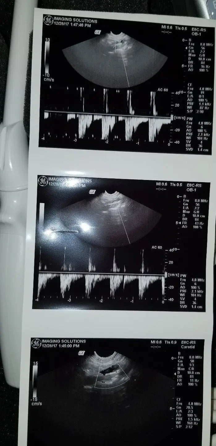 GE E8C-RS Ultrasound Probe / Transducer Demo Condition DIAGNOSTIC ULTRASOUND MACHINES FOR SALE