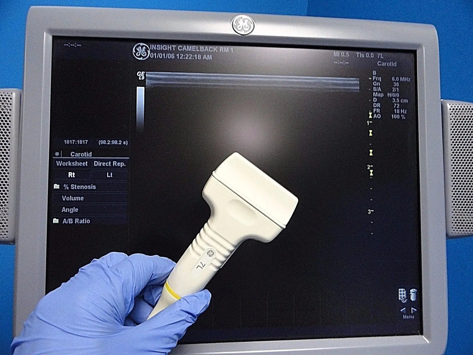 GE  7L / 2302648 Linear Array Ultrasound Probe for Logiq & Vivid Series~13787 DIAGNOSTIC ULTRASOUND MACHINES FOR SALE