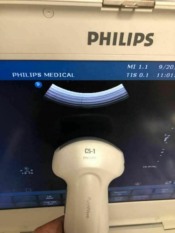 Philips C5-1 Ultrasound Transducer / Probe For CX50 Ultrasound Machine DIAGNOSTIC ULTRASOUND MACHINES FOR SALE