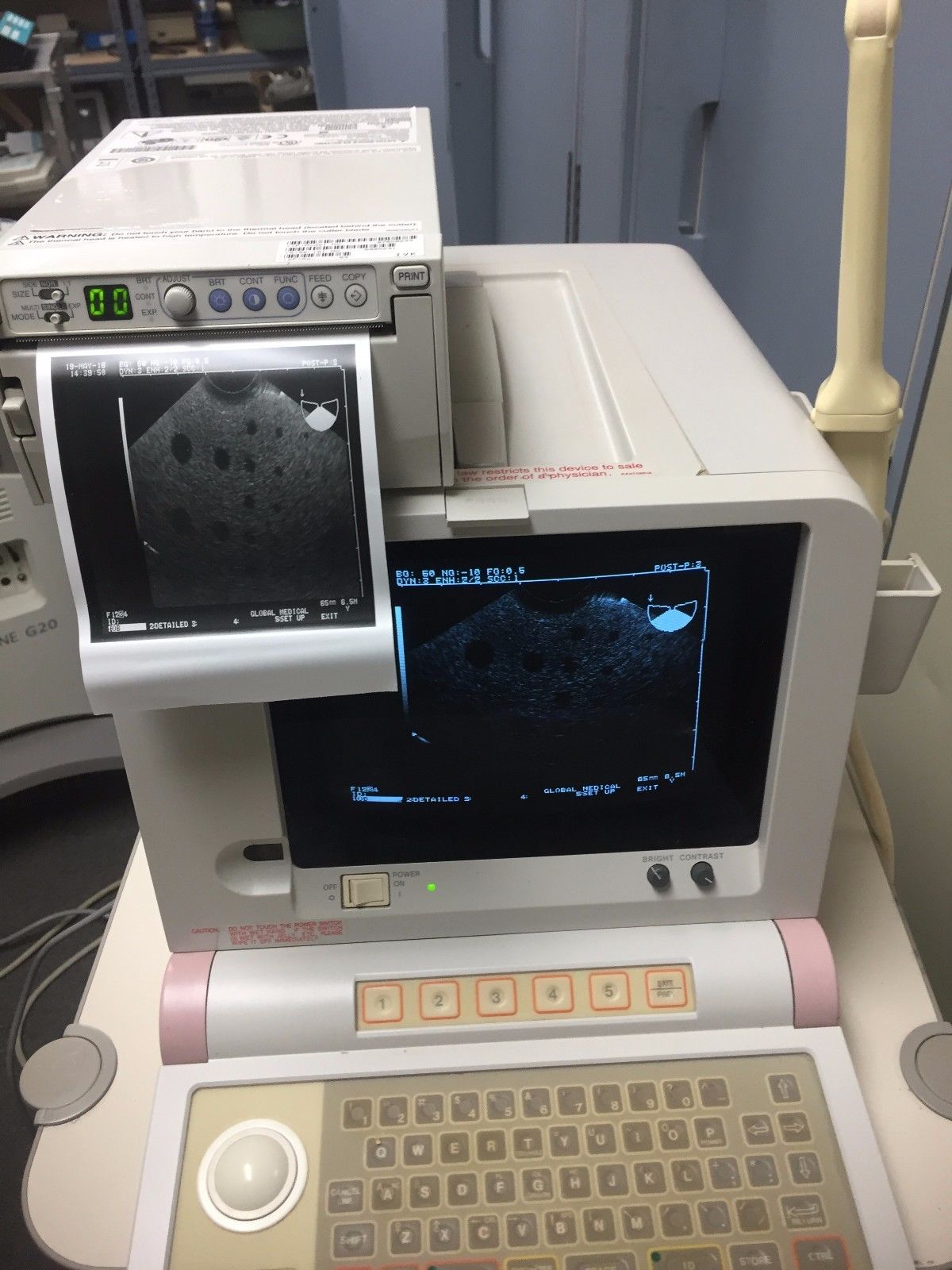 Hitachi EUB-405 Plus Ultrasound / 2 probes / 2 transducer port / printer DIAGNOSTIC ULTRASOUND MACHINES FOR SALE