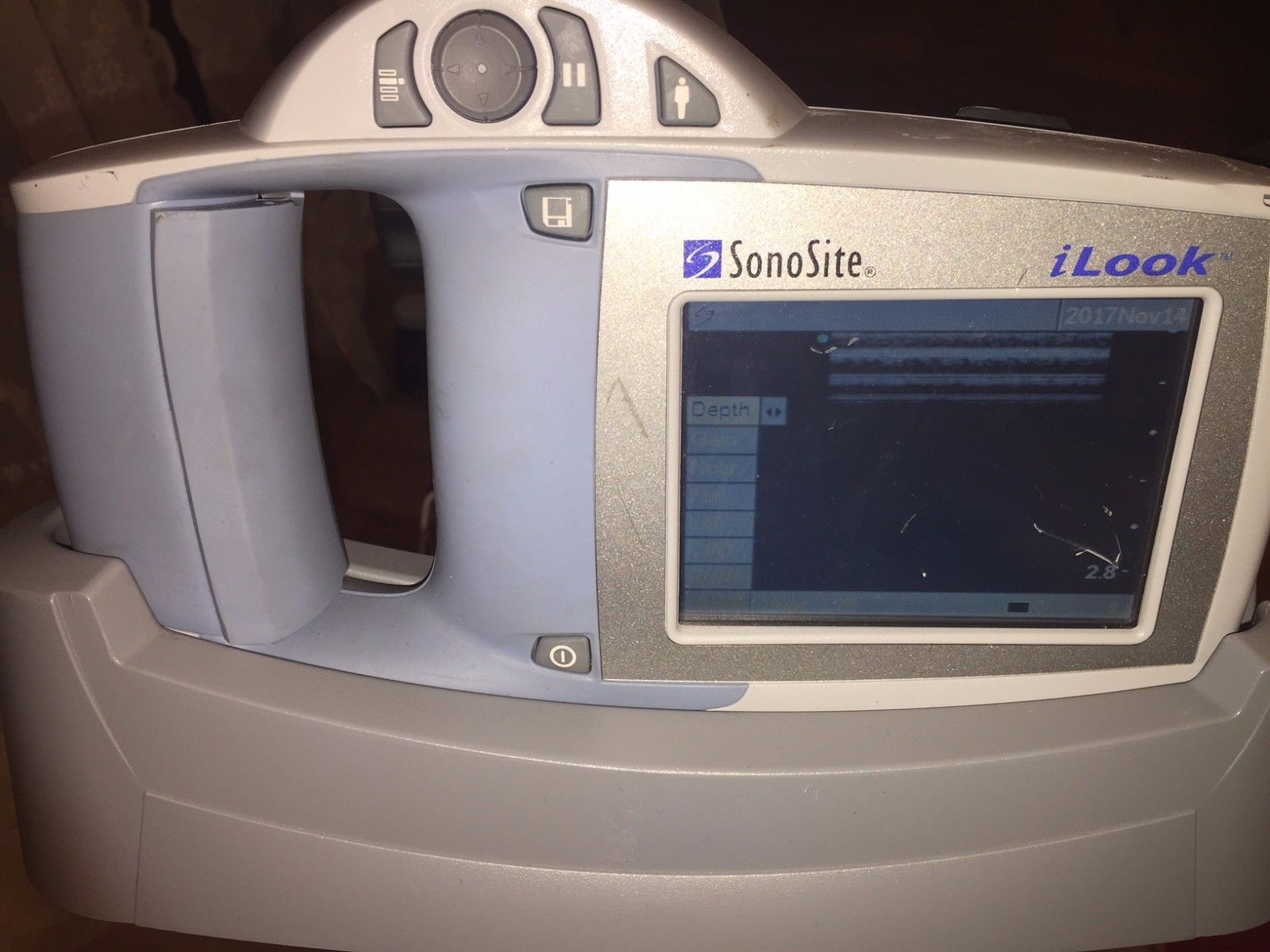 Ultrasound Sonosite iLook 25 with Linear Probe and Stand DOM2006 DIAGNOSTIC ULTRASOUND MACHINES FOR SALE