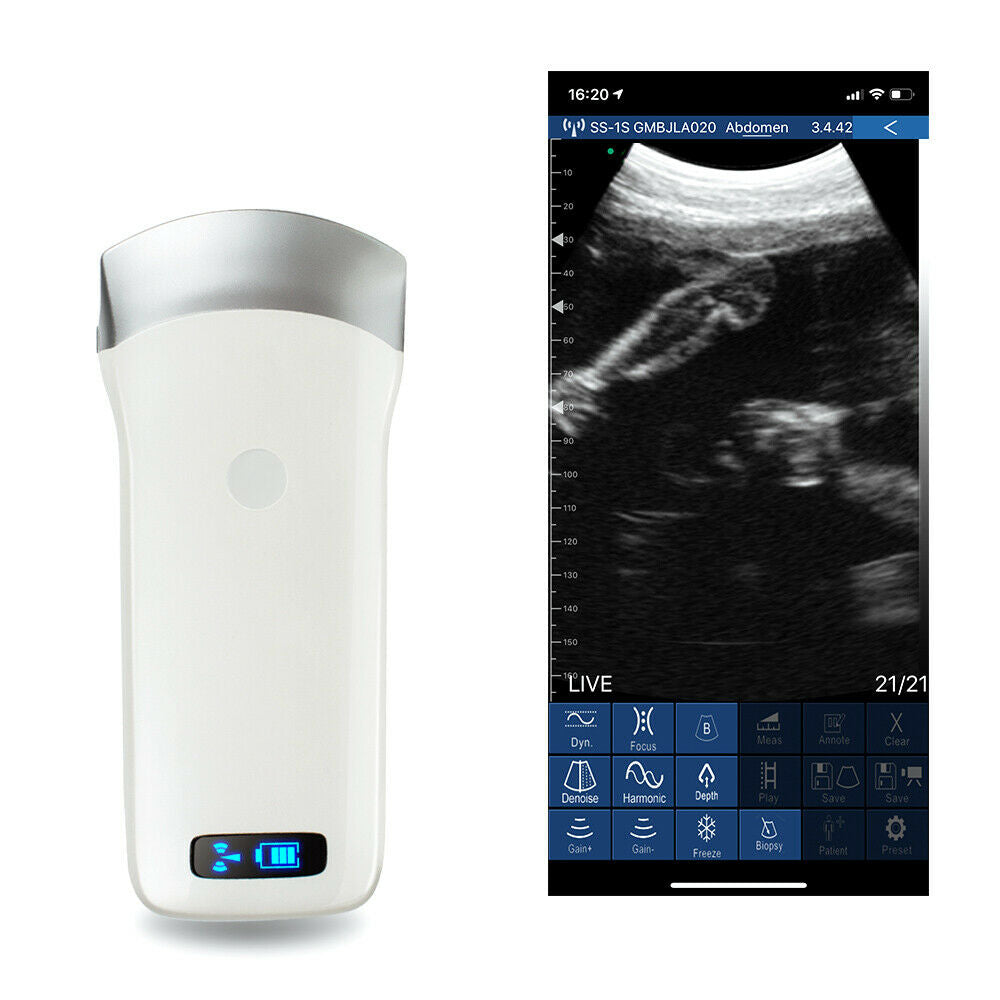 Portable WIFI Wireless Ultrasound Scanner Machine Convex Probe 3.5Mhz Medical CE DIAGNOSTIC ULTRASOUND MACHINES FOR SALE