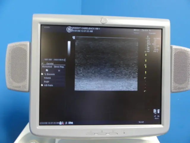 GE  7L Linear Array Ultrasound Transducer for Logiq & Vivid Series (10760) DIAGNOSTIC ULTRASOUND MACHINES FOR SALE