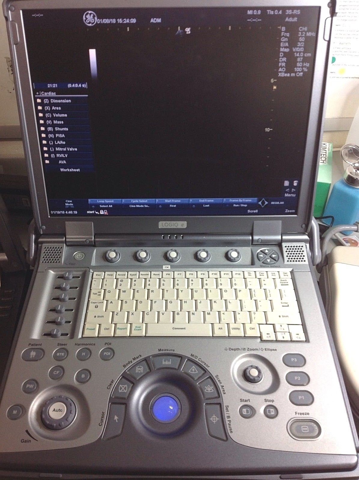 2010 GE LOGIQ E BT10 PORTABLE ULTRASOUND WITH CARDIAC PROBE. WORKS FINE DIAGNOSTIC ULTRASOUND MACHINES FOR SALE