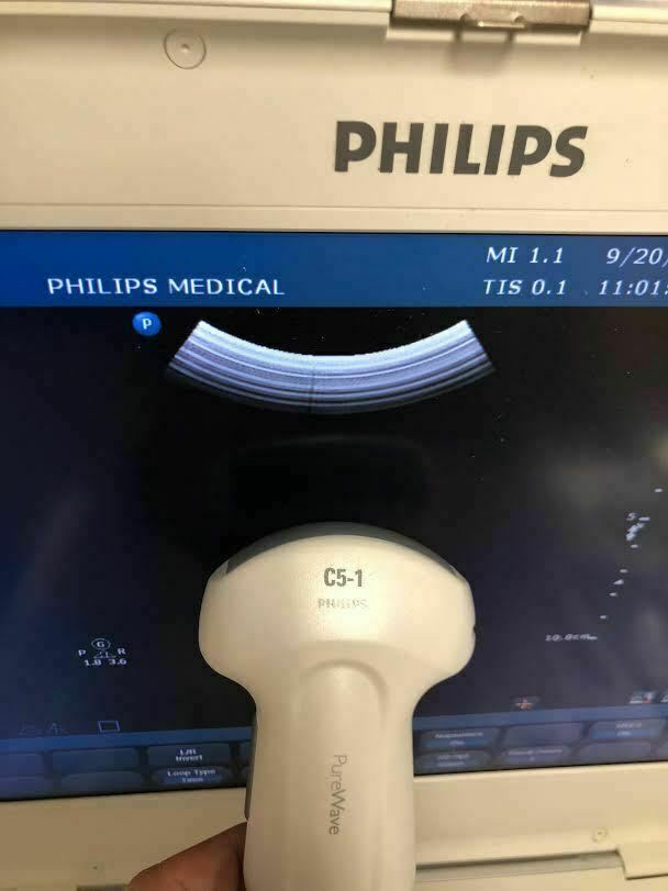 Philips CX50 Portable Ultrasound Machine with C5-1 Ultrasound Probe Transducer DIAGNOSTIC ULTRASOUND MACHINES FOR SALE