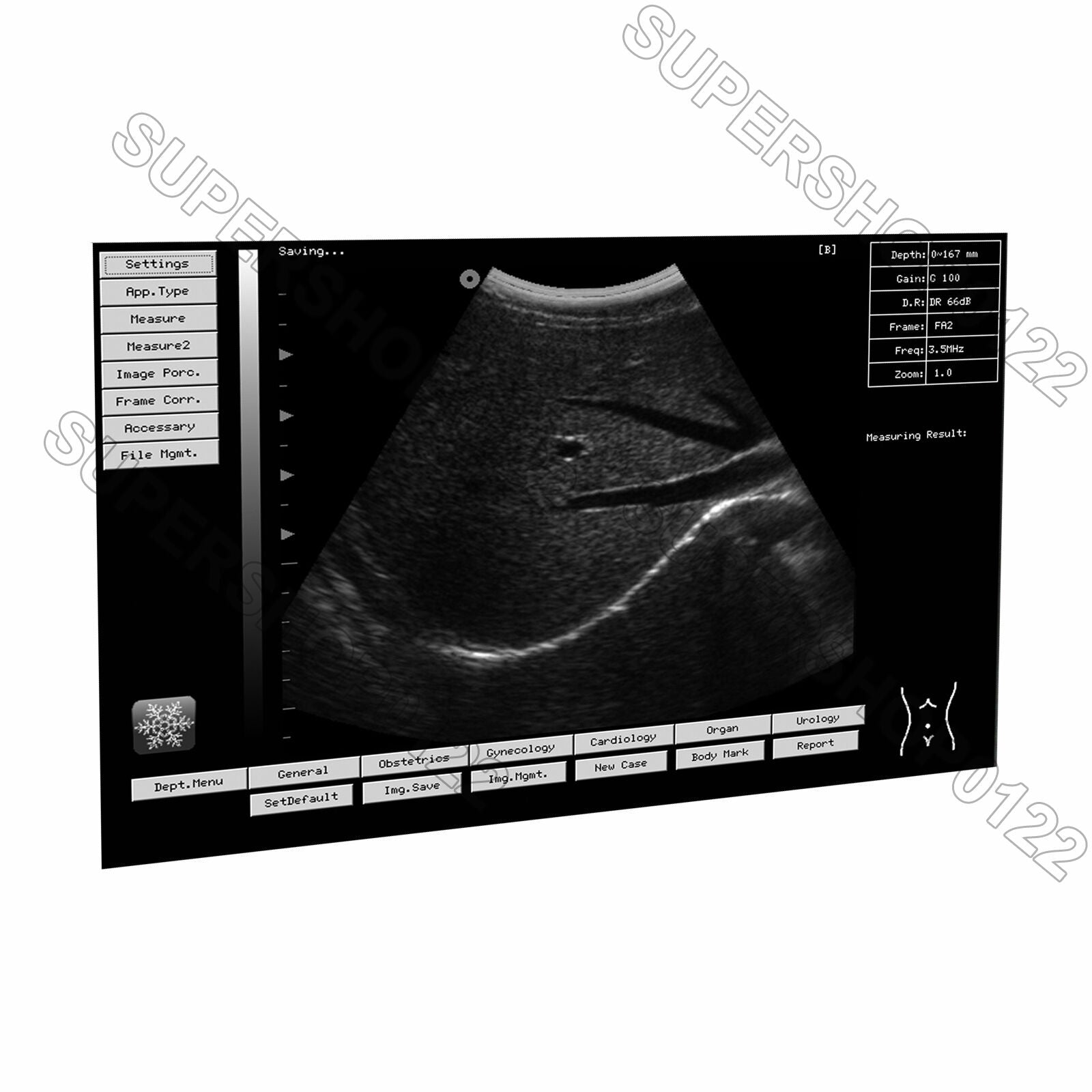 Digital Portable Notebook Laptop Ultrasound machine Scanner system CONVEX PROBE DIAGNOSTIC ULTRASOUND MACHINES FOR SALE