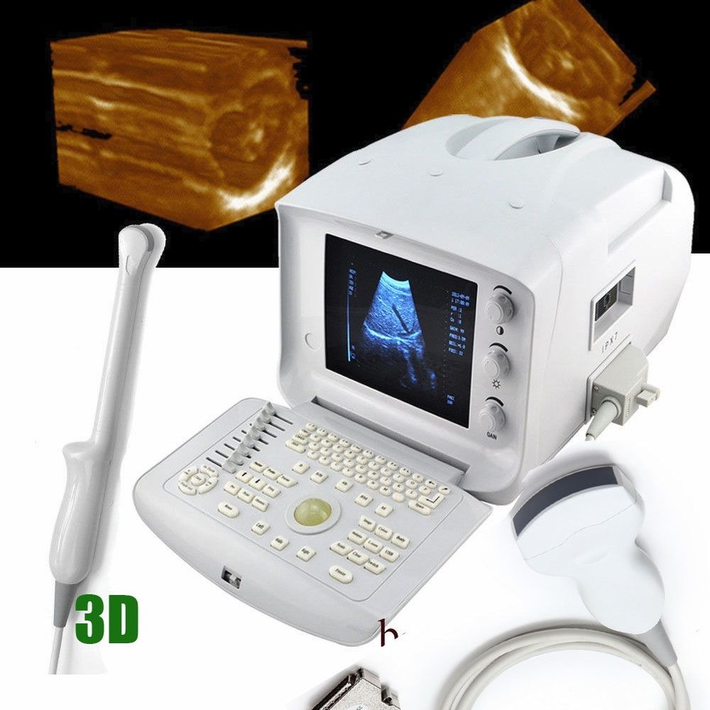 Free 3D Digital Ultrasound Scanner Machine  Convex /Curve Vignial 2 probes USB 190891933249 DIAGNOSTIC ULTRASOUND MACHINES FOR SALE