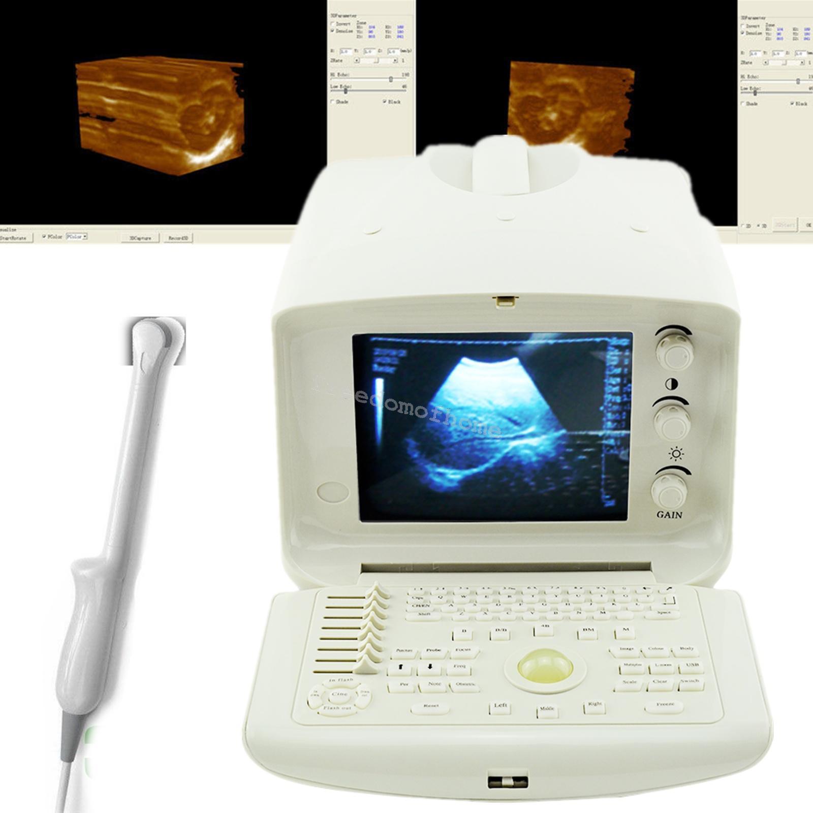 Full Digital Portable Ultrasound Scanner machine +Convex + Vignial  2 Probes+3D DIAGNOSTIC ULTRASOUND MACHINES FOR SALE