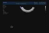 Philips C9-5EC Endocavitary Endorectal Probe Ultrasound Transducer