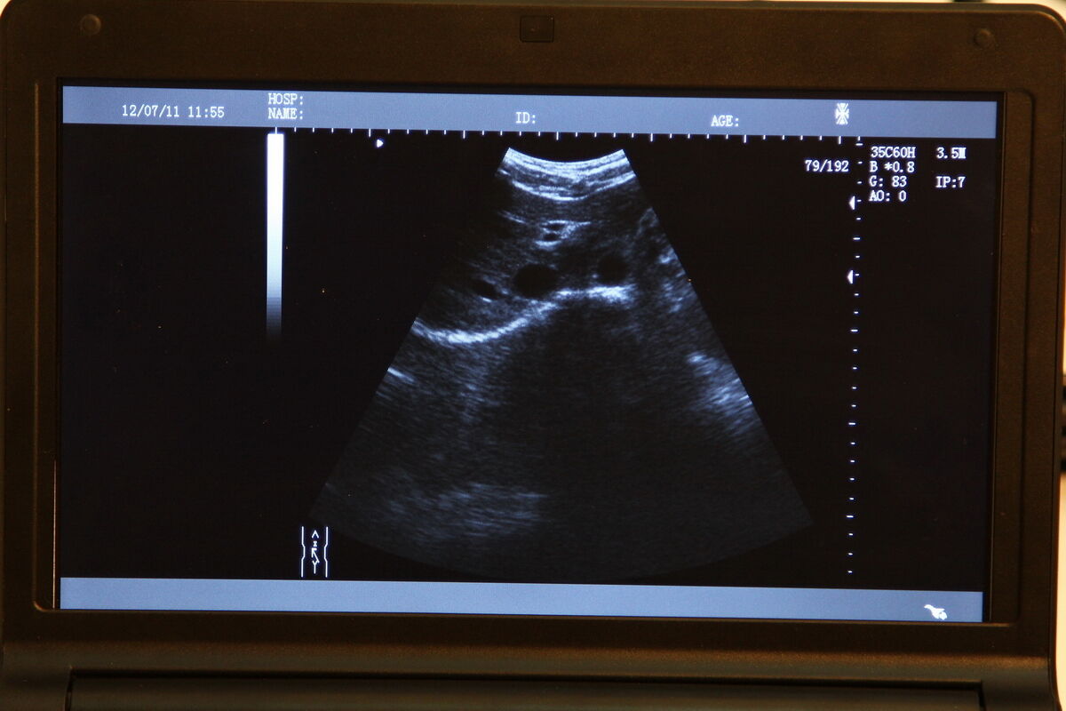 SALE! Medical Laptop Digital Ultrasound Scanner Machine+Convex/Rectal 2Probes DIAGNOSTIC ULTRASOUND MACHINES FOR SALE