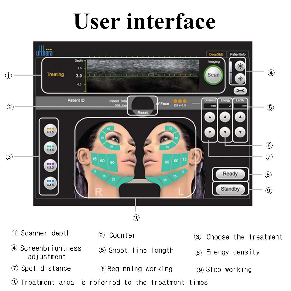 High Intensity Focused Ultrasound HIFU Facial Skin Care Spa Anti Aging Machine DIAGNOSTIC ULTRASOUND MACHINES FOR SALE