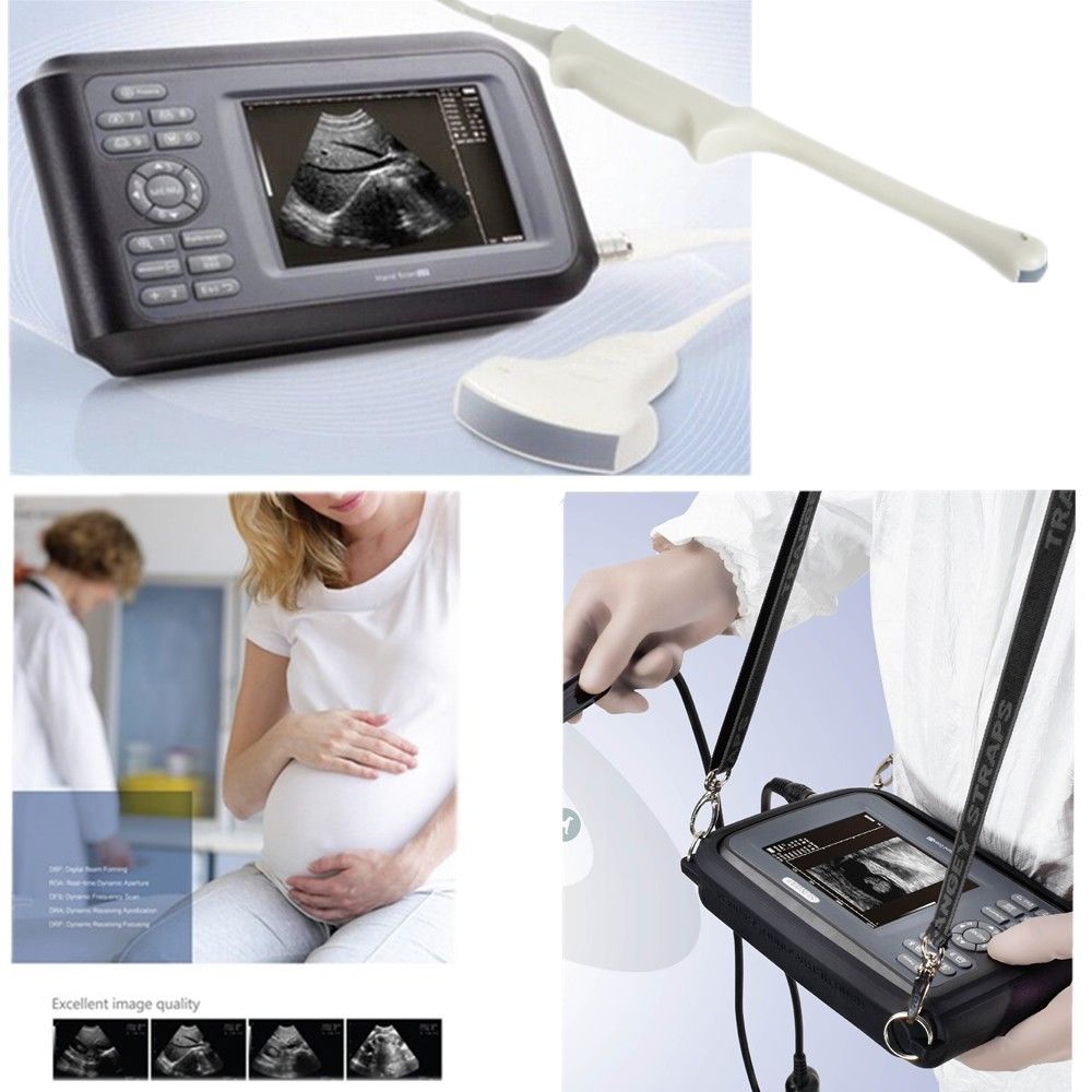 Human Laptop Machine Ultrasound Scanner System Convex + Transvaginal Probe+ Case DIAGNOSTIC ULTRASOUND MACHINES FOR SALE
