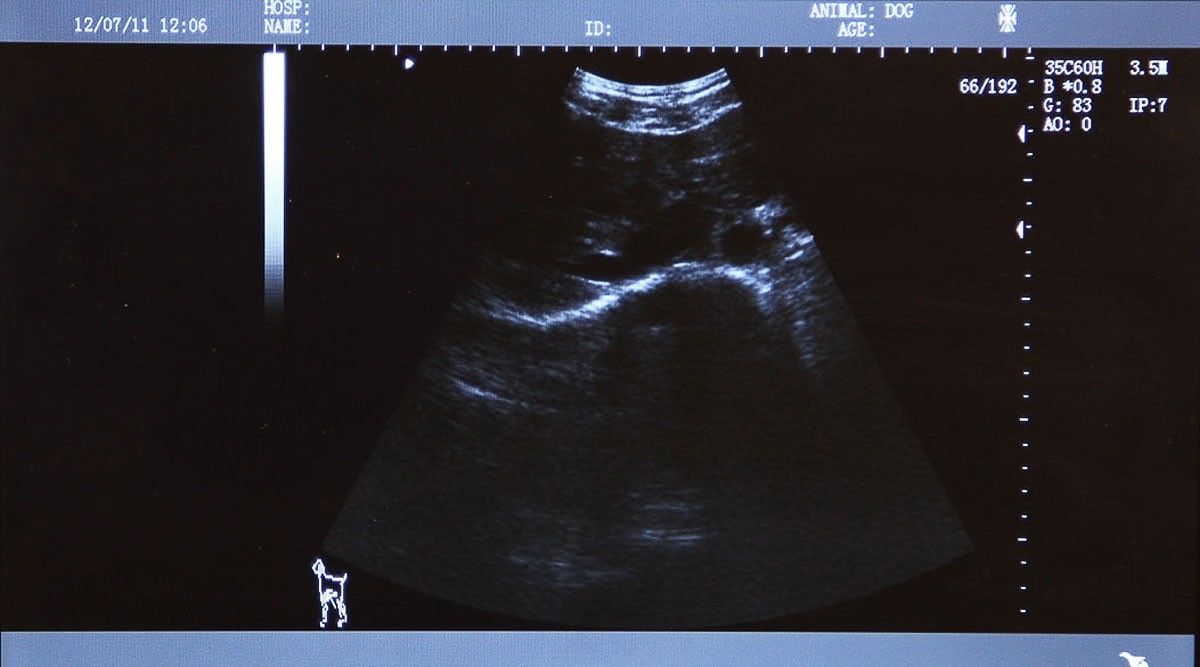 Full Digital Laptop VET Veterinary Ultrasound Scanner MACHINE + rectal PROBE 3D 190891579843 DIAGNOSTIC ULTRASOUND MACHINES FOR SALE