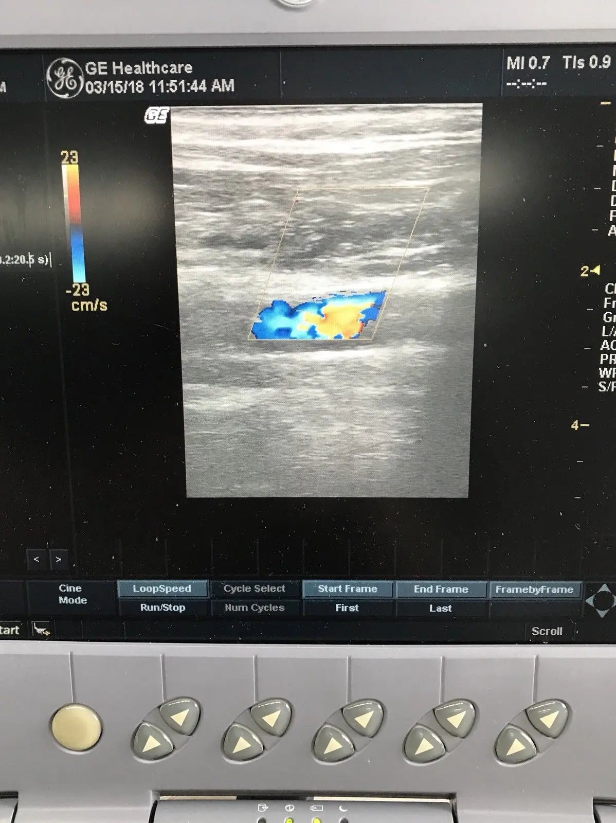 GE Logiq Book XP with 2 x Ultrasound Probes. Linear and Convex 2011 DIAGNOSTIC ULTRASOUND MACHINES FOR SALE