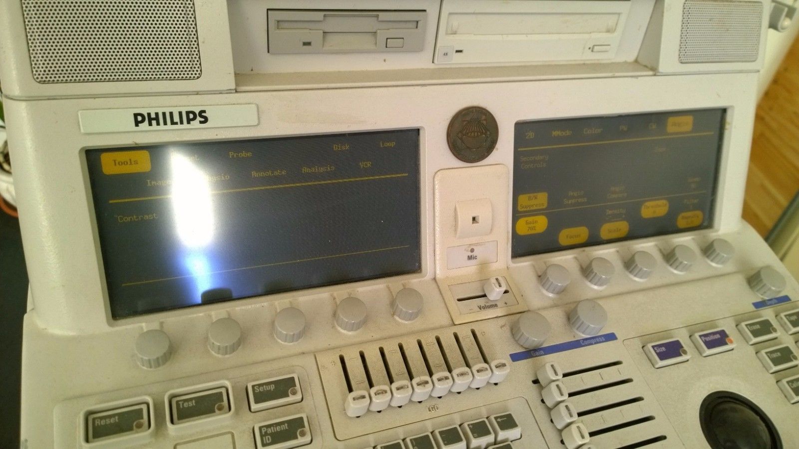 HP/Philips Sonos 5500 1997 Ultrasound