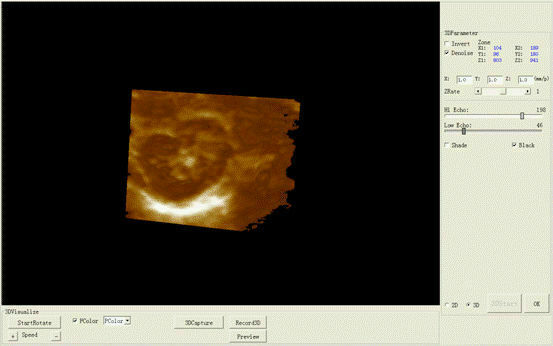 Portable Medical Laptop Diagnostic Ultrasound Scanner 3.5 Convex probe+Free 3D DIAGNOSTIC ULTRASOUND MACHINES FOR SALE