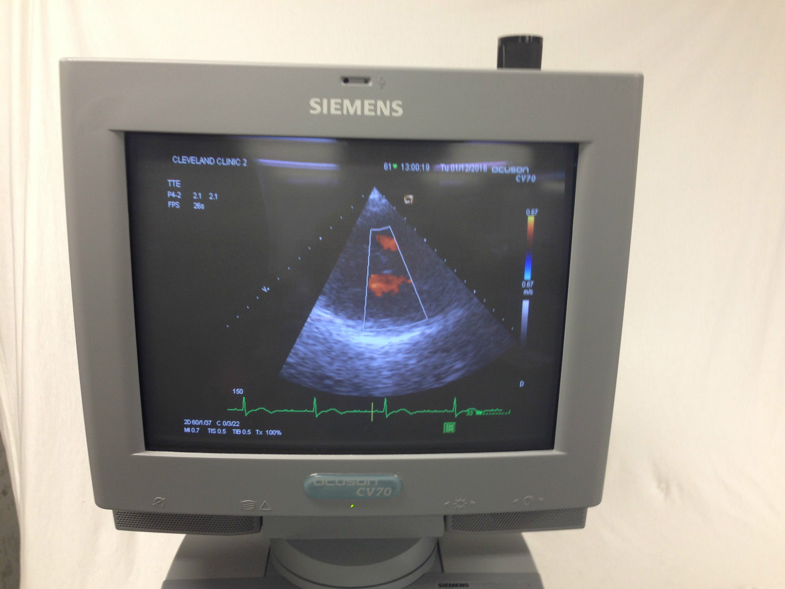 Siemens Acuson CV70 Cardiac Vascular Ultrasound Machine. L10-5 P4-2 Included DIAGNOSTIC ULTRASOUND MACHINES FOR SALE