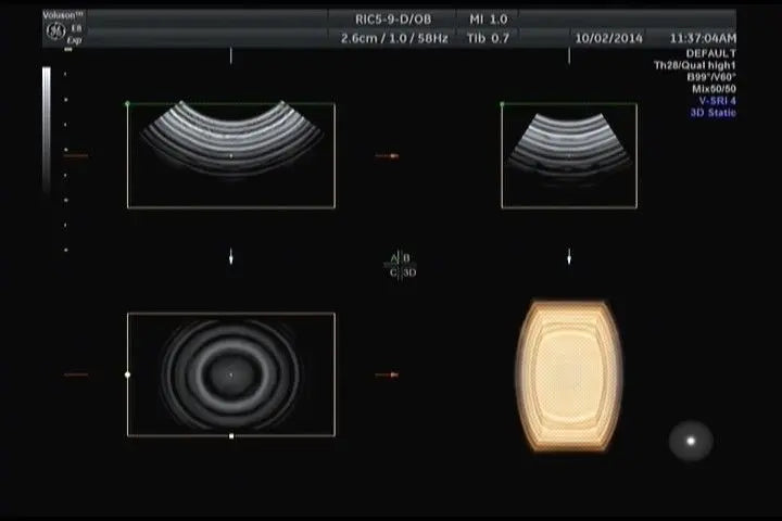 GE RIC5-9-D Ultrasound Transducer DIAGNOSTIC ULTRASOUND MACHINES FOR SALE