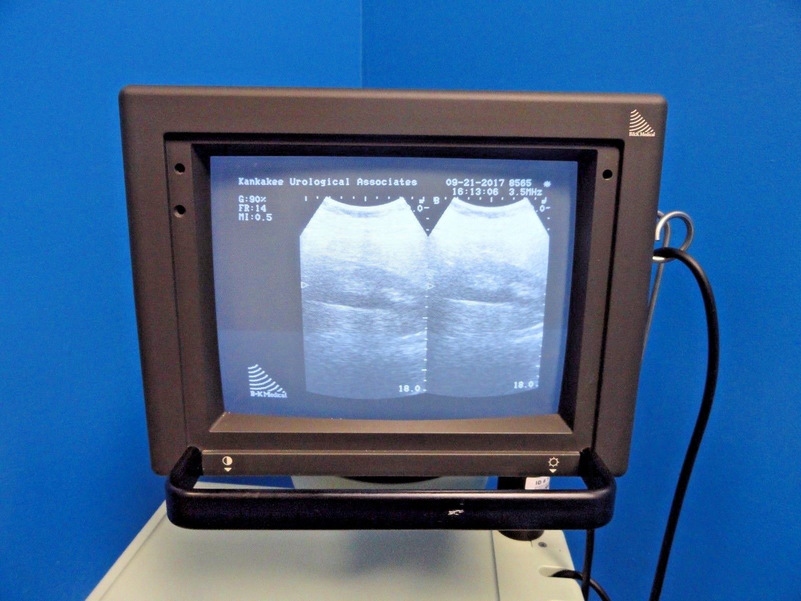 BK Medical Leopard 2001 Ultrasound W/ 8565 Convex Probe & Manual ~13544 DIAGNOSTIC ULTRASOUND MACHINES FOR SALE