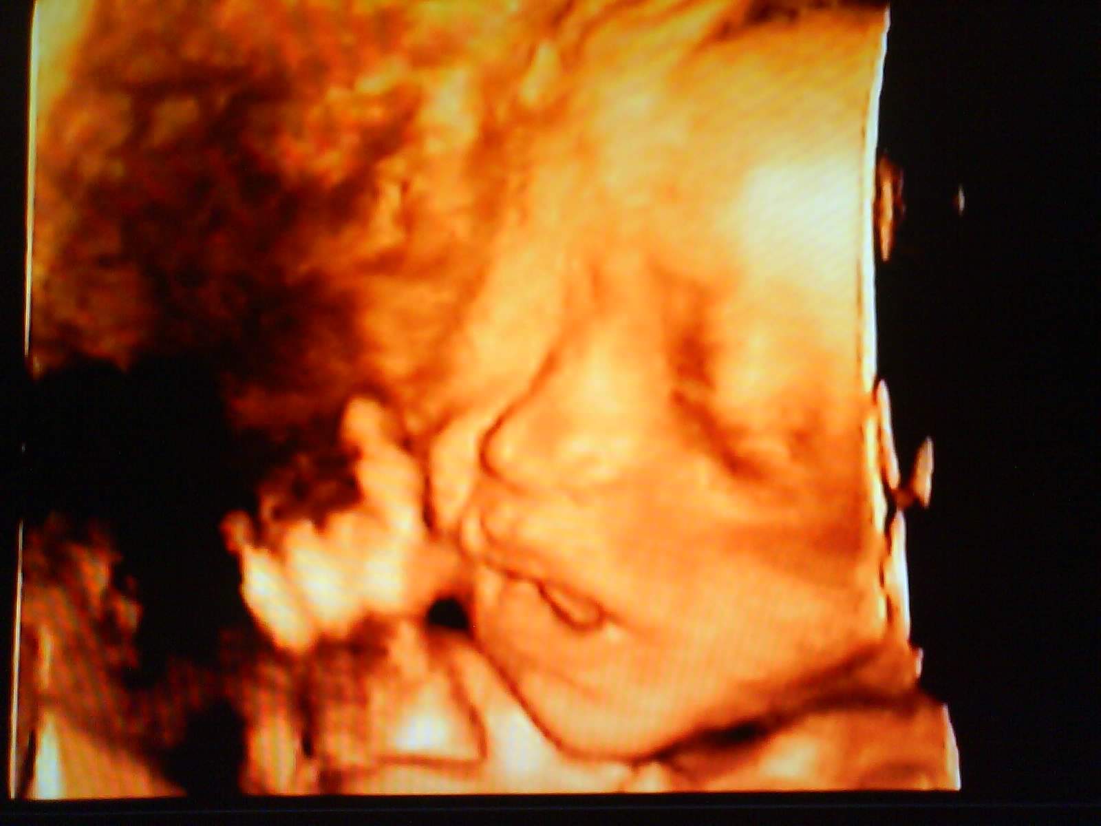 Full Digital Color Doppler Ultrasound Scanner Convex + Linear 2 Sensors/Probe A+ 190891277251 DIAGNOSTIC ULTRASOUND MACHINES FOR SALE