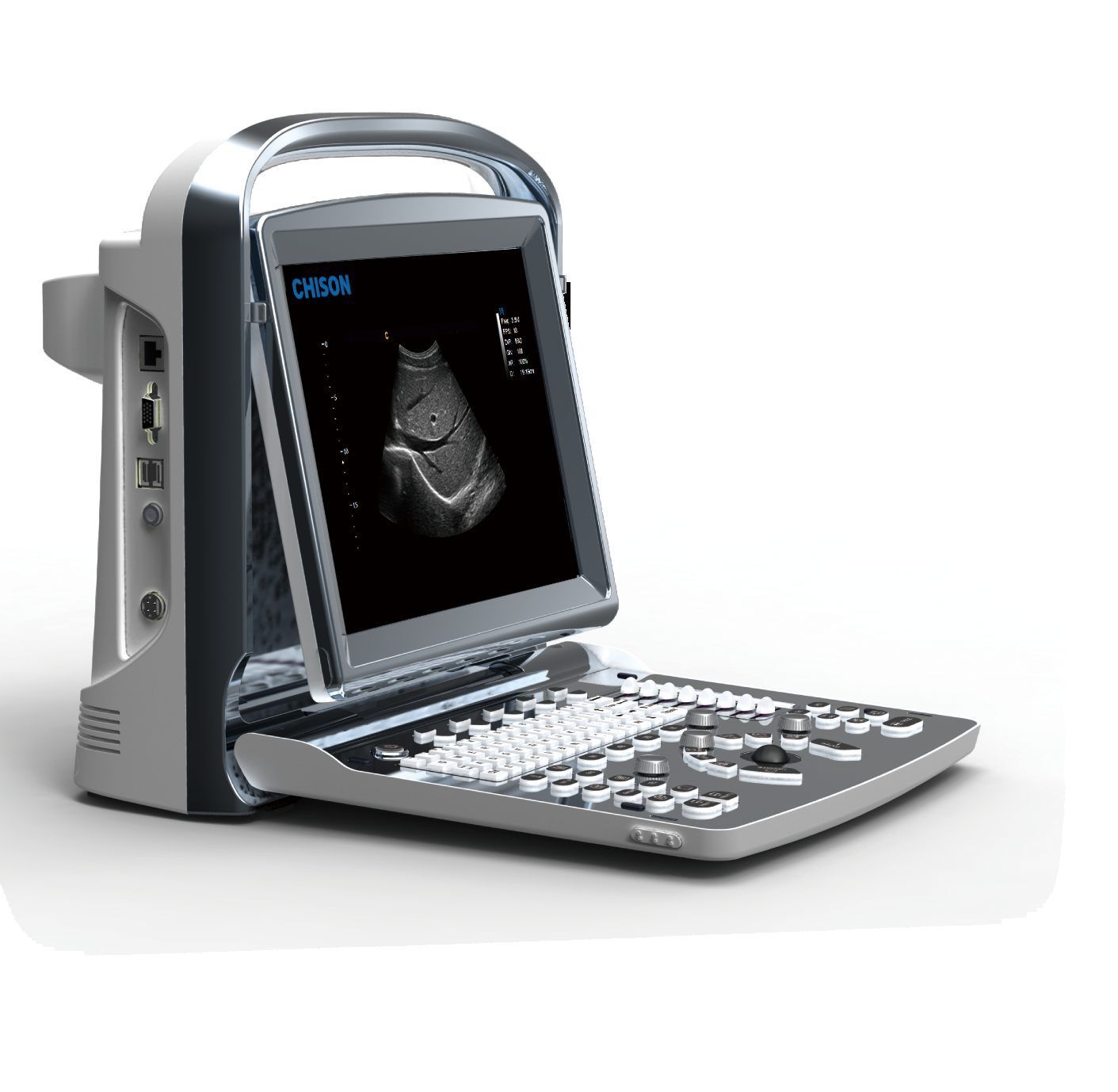 Chison ECO1 Ultrasound System *NEW* DIAGNOSTIC ULTRASOUND MACHINES FOR SALE