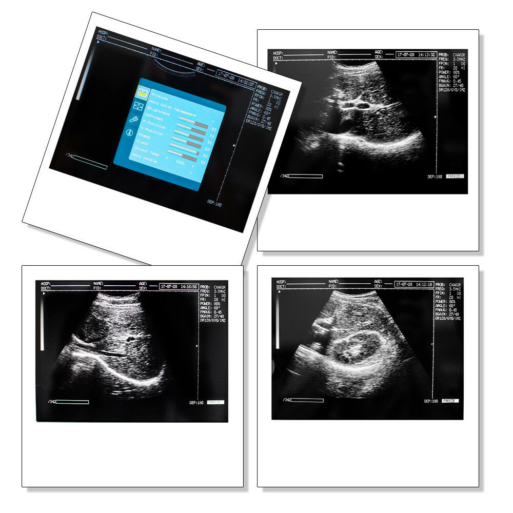 Notebook/Laptop Digital Ultrasound Scanner Convex/Abdominal Probe US STOCK DIAGNOSTIC ULTRASOUND MACHINES FOR SALE