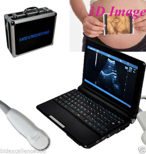 10.1'' Digital Laptop Ultrasound Scanner System W 5.0MHz Micro-convex Probe +bag DIAGNOSTIC ULTRASOUND MACHINES FOR SALE