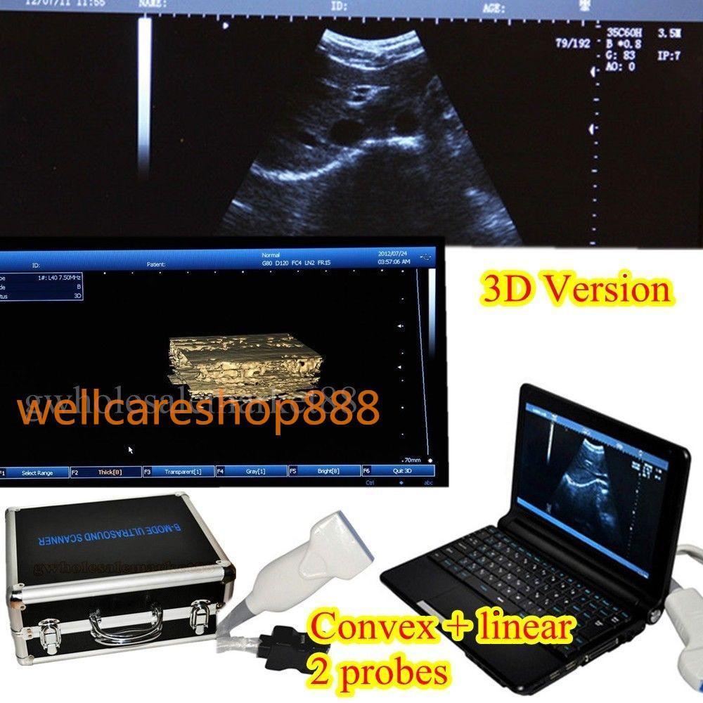 LCD PC Digital Laptop Ultrasound Scanner Machine+Convex Linear Probe+3D Image CE 190891798732 DIAGNOSTIC ULTRASOUND MACHINES FOR SALE