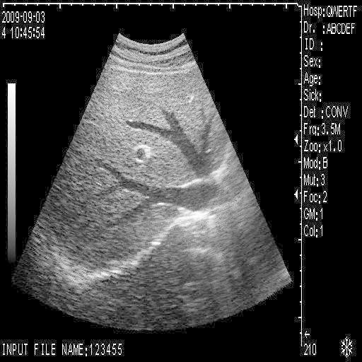 New +3D Digital Ultrasound Scanner +Convex Transvaginal probes 2 probes Set Sale 190891051066 DIAGNOSTIC ULTRASOUND MACHINES FOR SALE