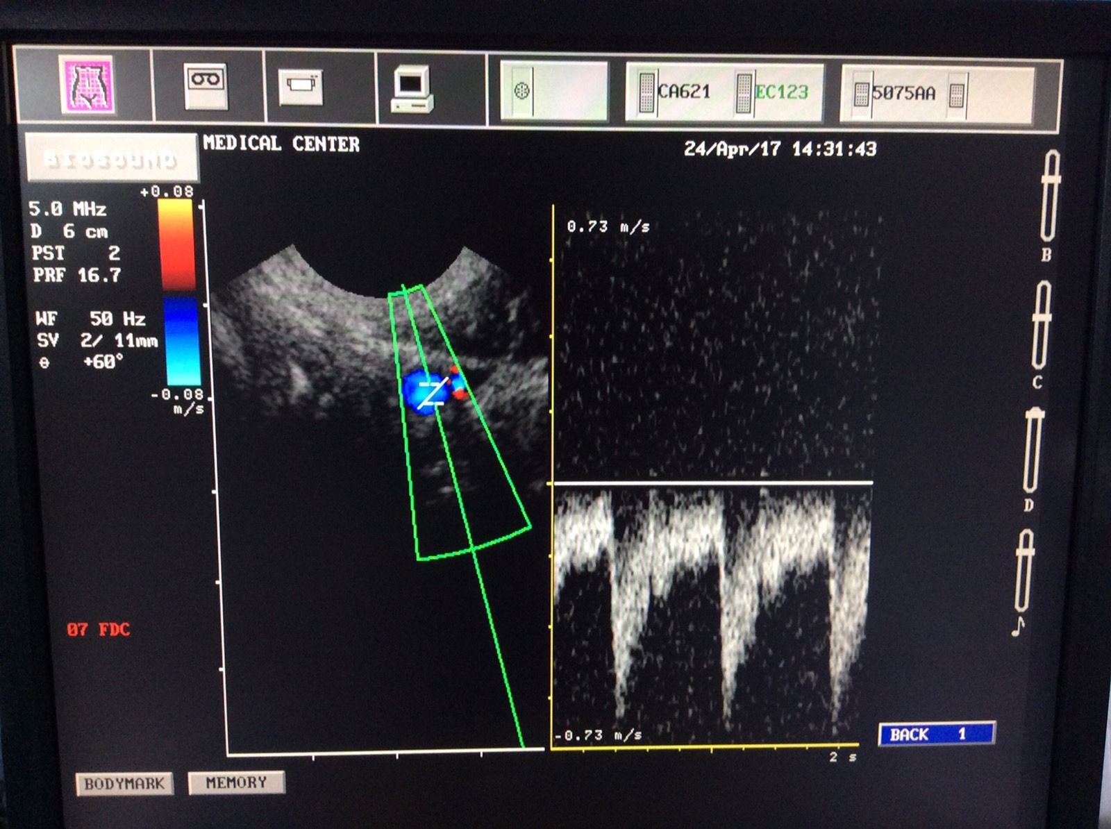 Esaote Biosound, MyLab ultrasound EC123 endovaginal probe DIAGNOSTIC ULTRASOUND MACHINES FOR SALE