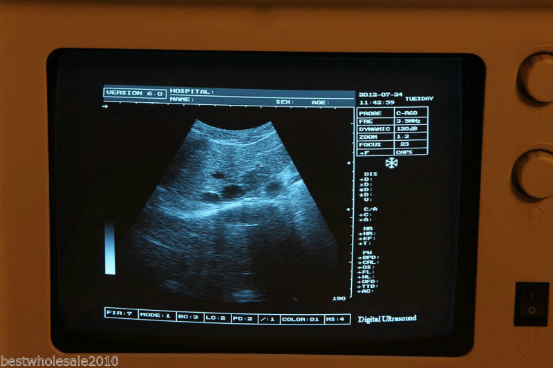 Digital Ultrasound Scanner B ultrasonic Machine Convex Micro-Convex  2 probe 3D 190891391452 DIAGNOSTIC ULTRASOUND MACHINES FOR SALE