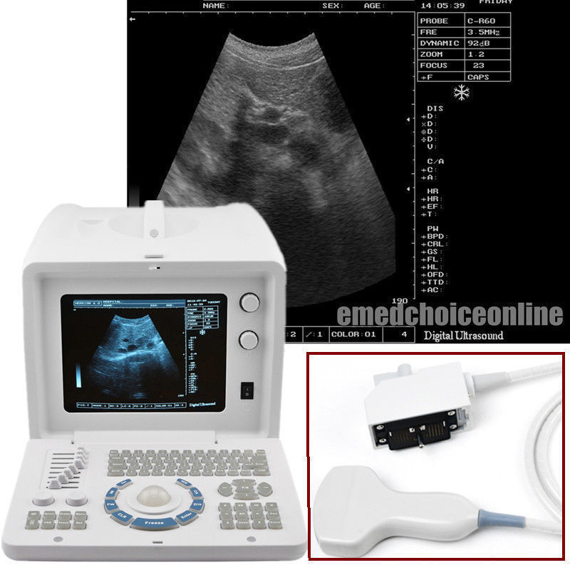 Medical  B Ultrasound Ultrasound Scanner Machine + Linear Probe/Sensor + 3D A+ 190891833112 DIAGNOSTIC ULTRASOUND MACHINES FOR SALE
