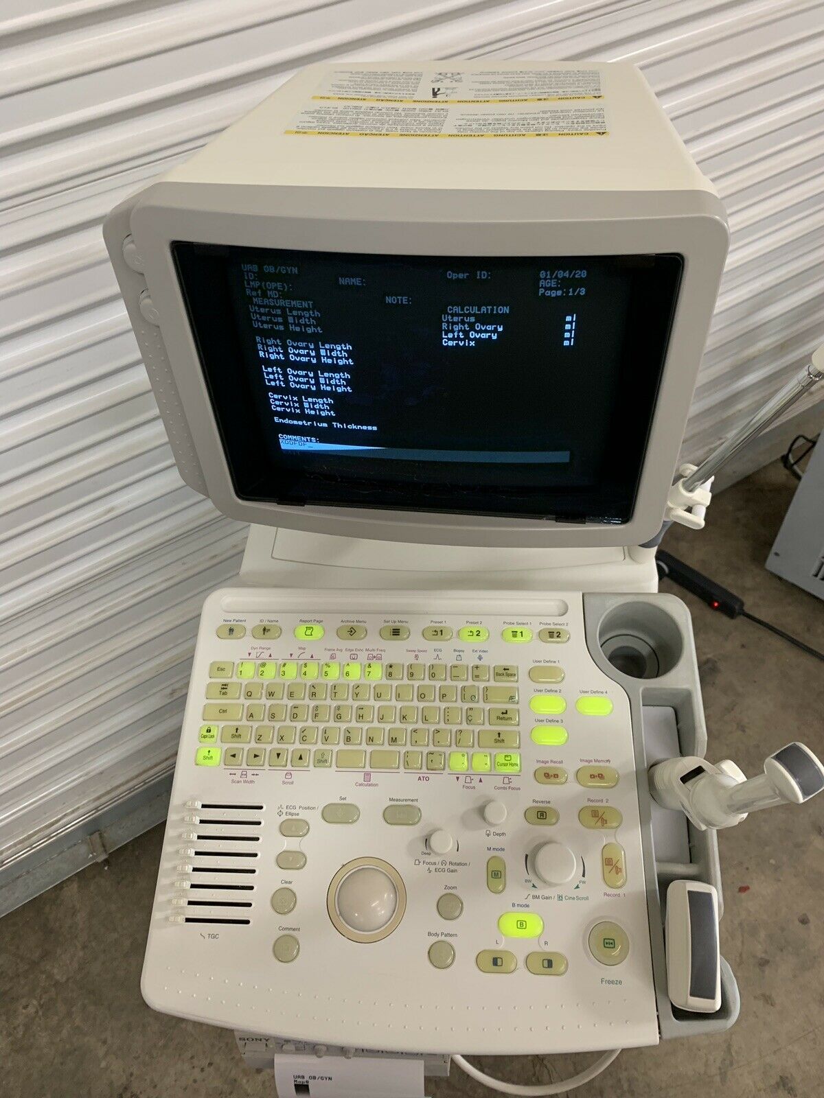 GE Pro Series Ultrasound Machine 2270969 w/ MTZ & 3Cb Probes Transducers DIAGNOSTIC ULTRASOUND MACHINES FOR SALE