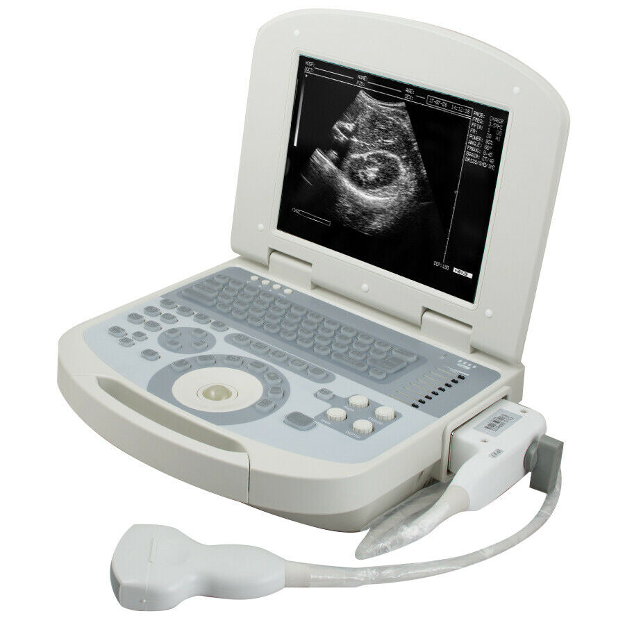 Portable Laptop Ultrasound Scanner 3.5MHz Convex Medical Ultrasound Machine +3D DIAGNOSTIC ULTRASOUND MACHINES FOR SALE