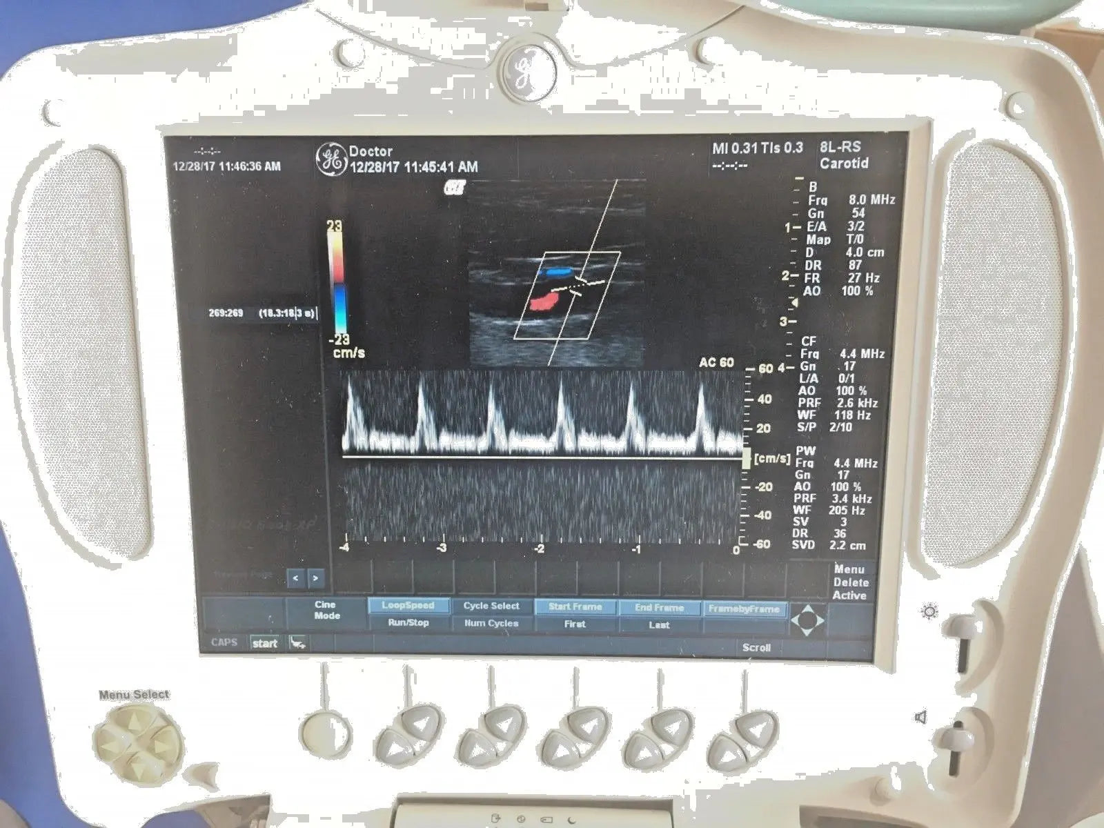 GE LogiqBook XP Porable Ultrasound with 3 transducers & Cart DIAGNOSTIC ULTRASOUND MACHINES FOR SALE