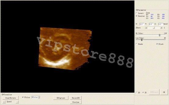 Digital Ultrasound Scanner Machine  +Convex +Vaginal + Linear 3 Probes/Sensor+3D DIAGNOSTIC ULTRASOUND MACHINES FOR SALE