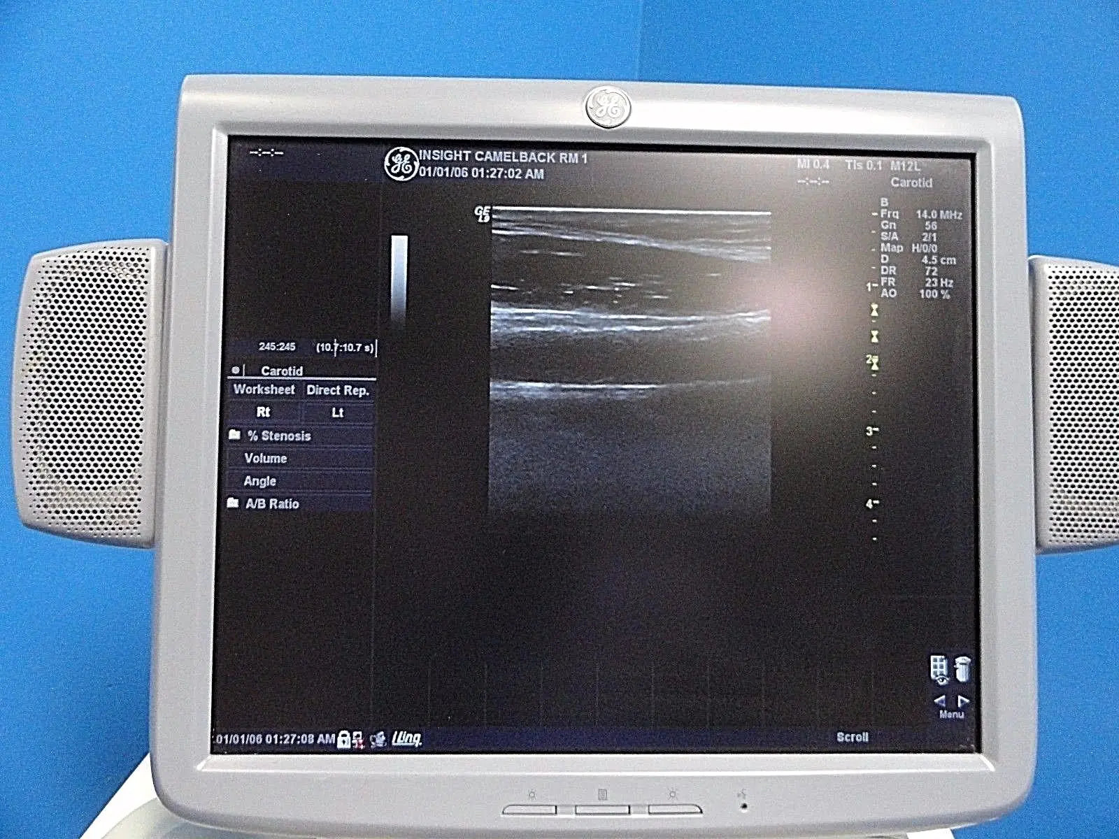 GE M12L P/N 2294512 Linear Array Ultrasound Probe for Logiq & Vivid Series~13722 DIAGNOSTIC ULTRASOUND MACHINES FOR SALE