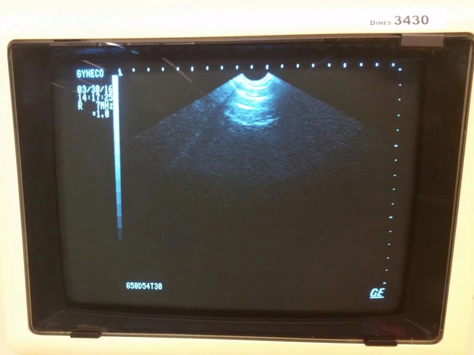 GE RT 3200 Advantage-I Ultrasound Inv 3430 DIAGNOSTIC ULTRASOUND MACHINES FOR SALE