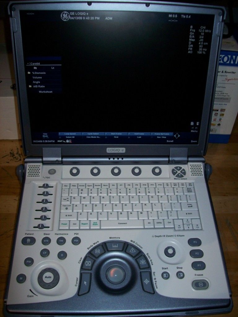 opened ultrasound laptop