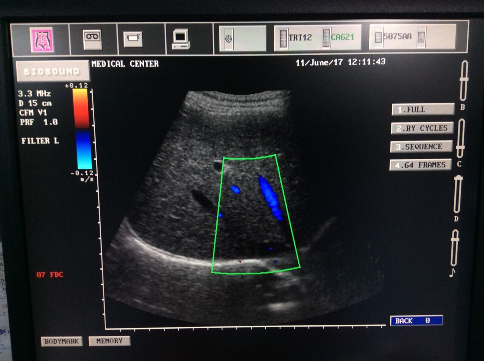 Esaote Biosound Megas/ MyLab ultrasound CA621 Convex probe DIAGNOSTIC ULTRASOUND MACHINES FOR SALE