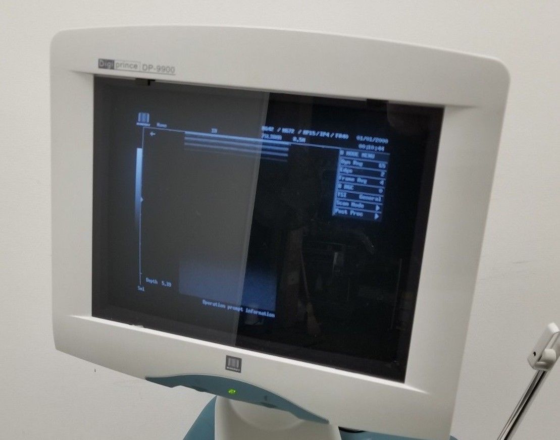 Mindray DigiPrince Model DP-9900 Ultrasound Diagnostic System w/ 2 Transducers DIAGNOSTIC ULTRASOUND MACHINES FOR SALE