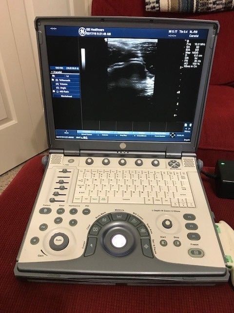 GE Logiq-E portable Ultrasound machine, MN 5148751 w/ 2 Probes and case DIAGNOSTIC ULTRASOUND MACHINES FOR SALE