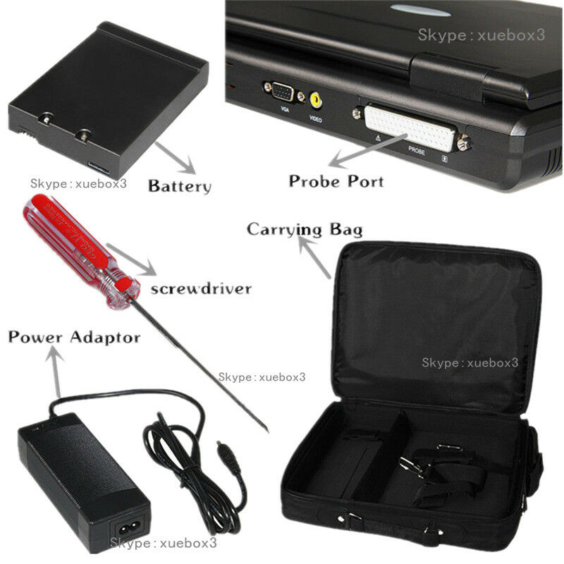 Portable laptop Digital Ultrasound scanner,pregnancy,Abdominal probe US seller 6945040100362 DIAGNOSTIC ULTRASOUND MACHINES FOR SALE