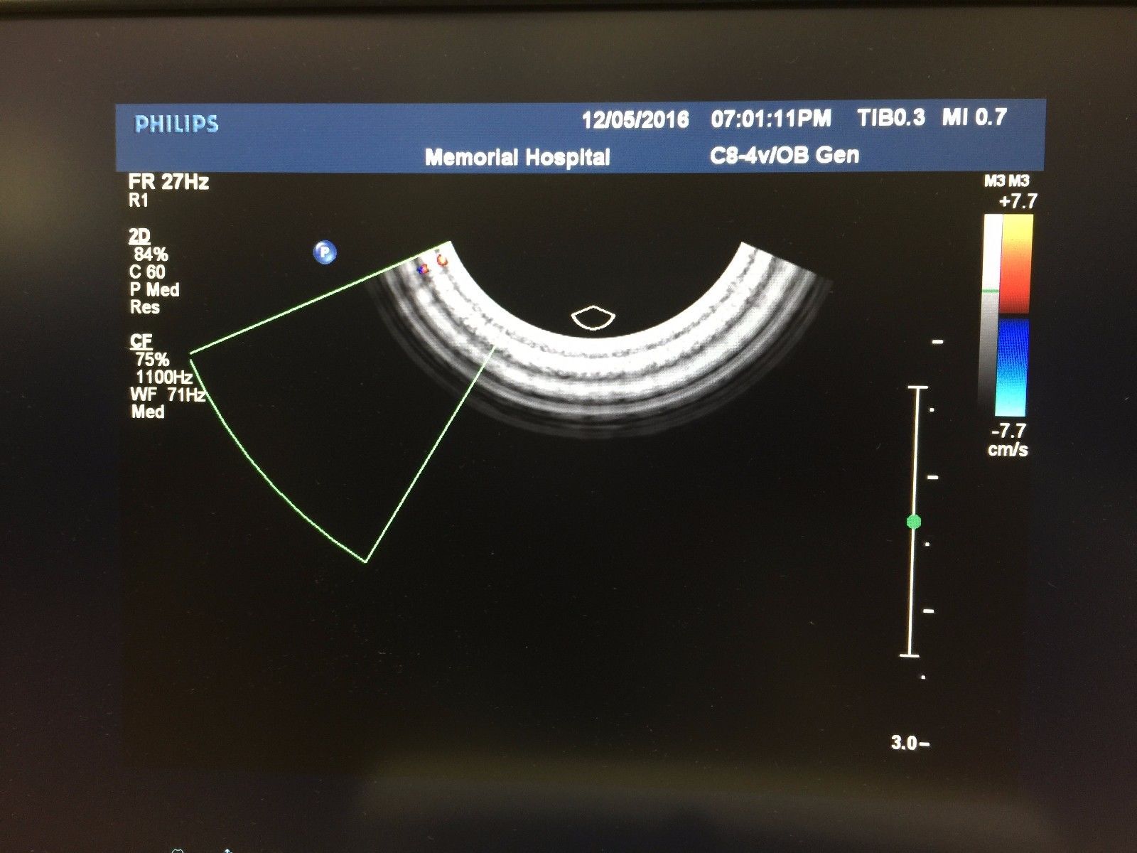 ultrasound scanner imaging wow