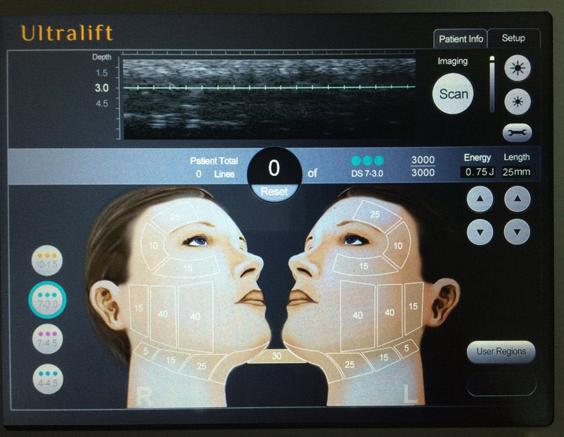 High Intensity Focused Ultrasound HIFU Ultrasonic RF Facial Anti Wrinkle Machine 601393982494 DIAGNOSTIC ULTRASOUND MACHINES FOR SALE