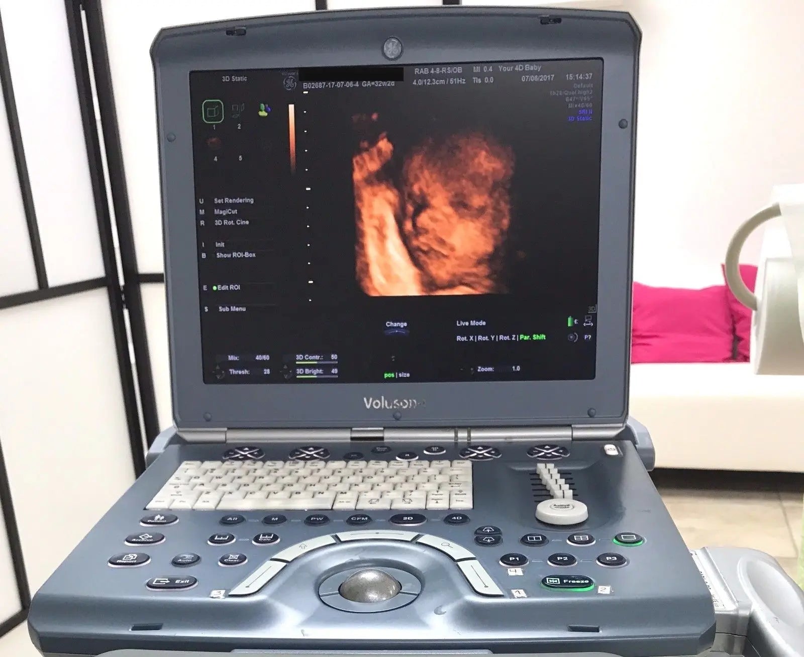 GE Voluson i Portable Ultrasound System DIAGNOSTIC ULTRASOUND MACHINES FOR SALE