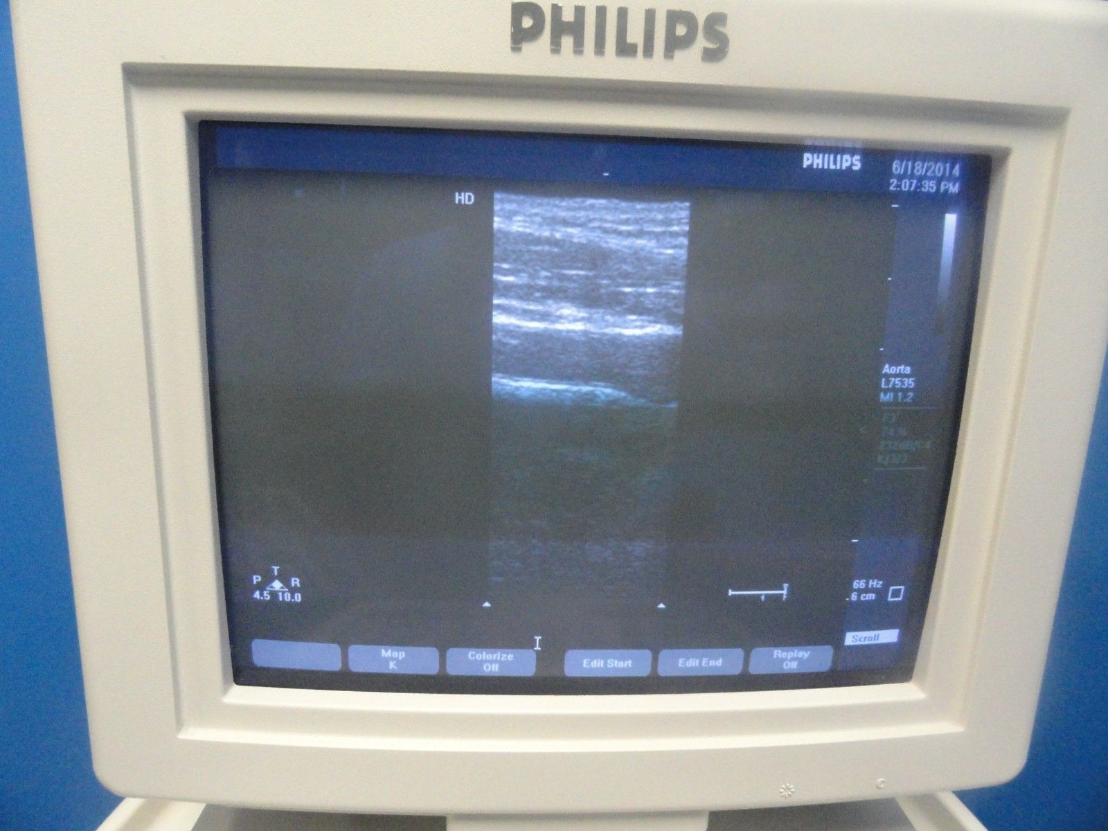 AGILIENT PHILIPS HP L7535 / 23159A  Linear Array Vascular Ultrasound Probe 6770