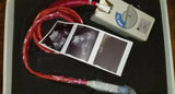 GE AB2-7 Ultrasound Probe / Transducer