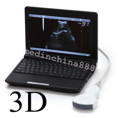 10-In Ultrasound Scanner+Convex+Linear+Transvaginal Probe+Thermal Printer Newest DIAGNOSTIC ULTRASOUND MACHINES FOR SALE