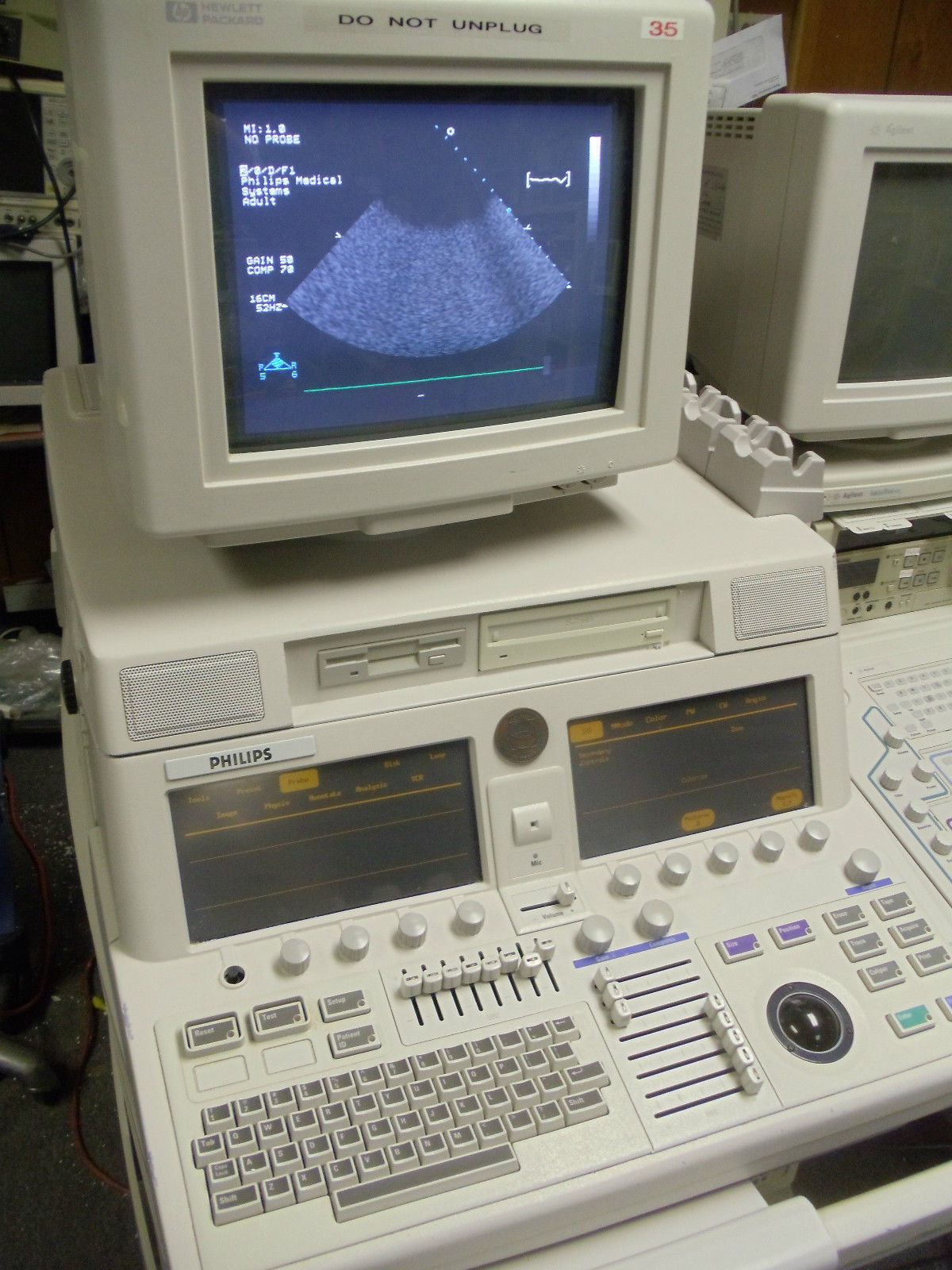 HP Sonos 5500 ultrasound system